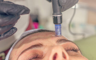 The Science Behind Microneedling with PRF: How It Works